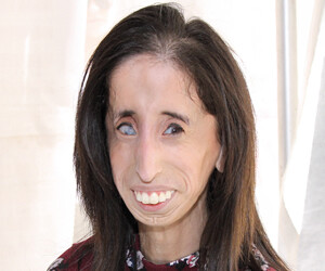 Lizzie Velásquez - images