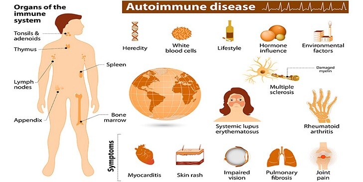 Autoimmune Diseases Quiz: Can You Identify Them All?
