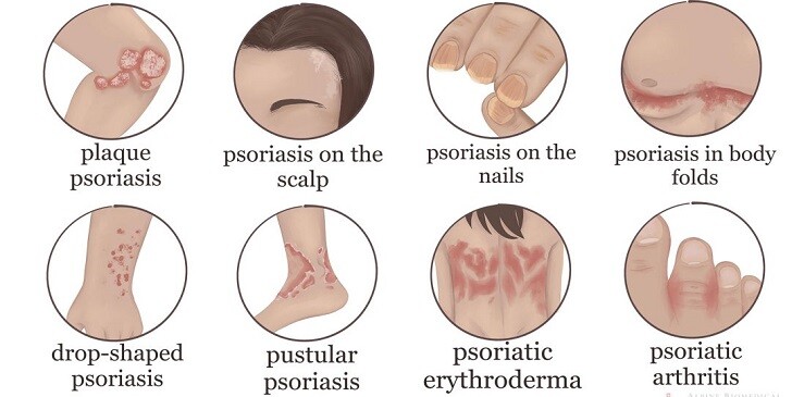 Disease Symptoms Quiz: Can You Guess the Illness?
