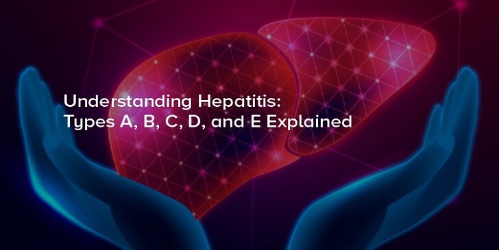 Hepatitis Quiz: Do You Know the A to E?